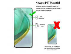 Coque gel Full 360 pour Xiaomi 15 Pro