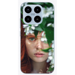 Coques Personnalisées Xiaomi 15T