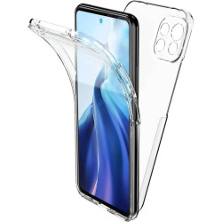 Coque gel Full 360 pour Xiaomi 17